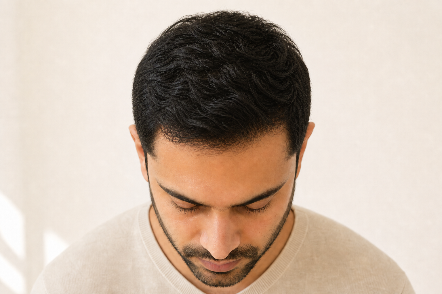 After 12 weeks — visible hair regrowth